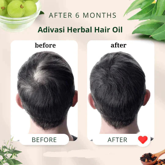 Adivasi Jeeva Sanjivani Herbal Hair🔥 BUY 1 GET 1 FREE🔥